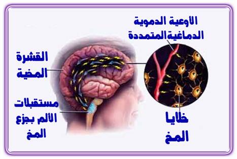 علاج الصداع النصفي 20161008 2091