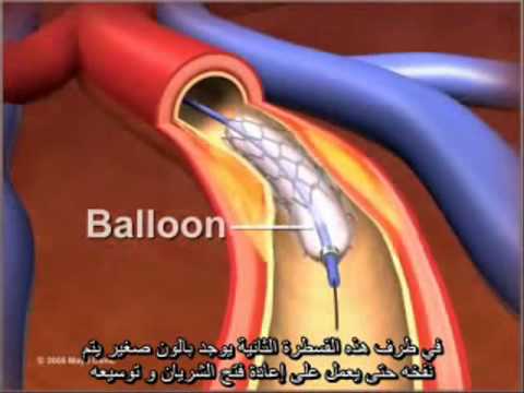 معناي قصطره قلب 20161010 266