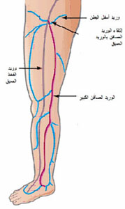 الم في الساقين