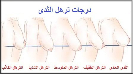 صدر عاري واجمل الفتيات 124469