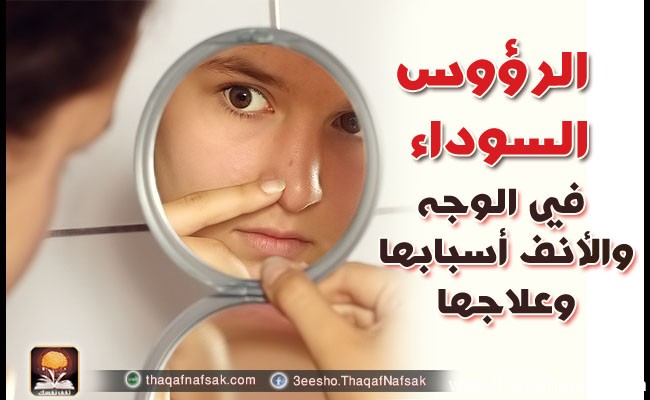 كيفية التخلص من الحبوب السوداء في الوجه