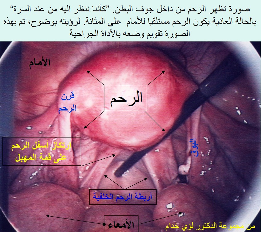 شكل الرحم من الداخل 20161007 382