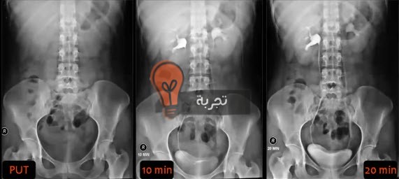 اضرار اشعة الصبغه 20161008 1301