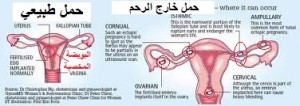 هل تحدث حمل بنزول دم قليل من الحيض 20160826 120