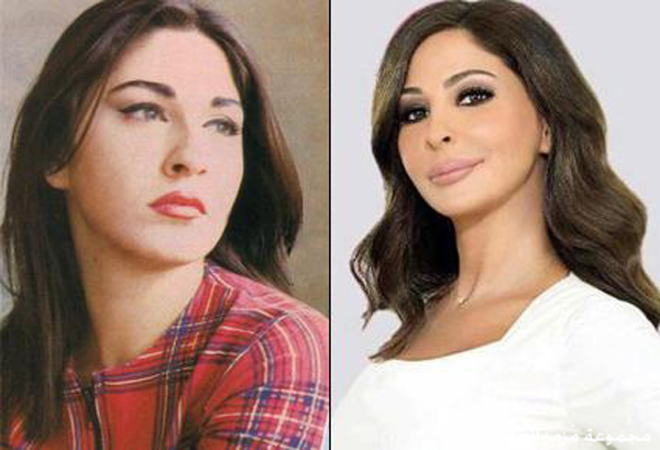 الفنانين قبل وبعد عمليات التجميل