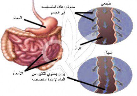 تعرف علي اعراض الاسهال الدهني