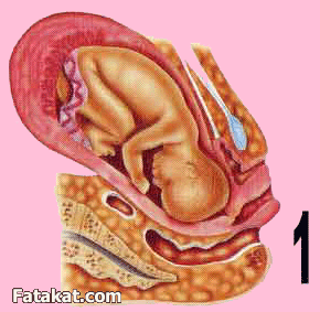 كيف يتم استخراج الجنين 20161015 115
