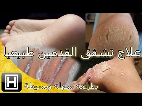 طرق العلاج بالاعشاب للقدمين 20161014 477