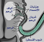 مرض في الرحم الالياف