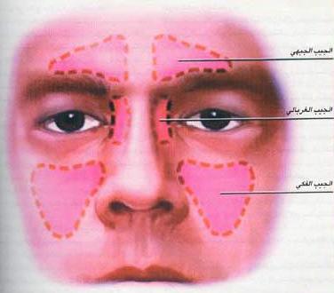 علاج الحساسية الانفية