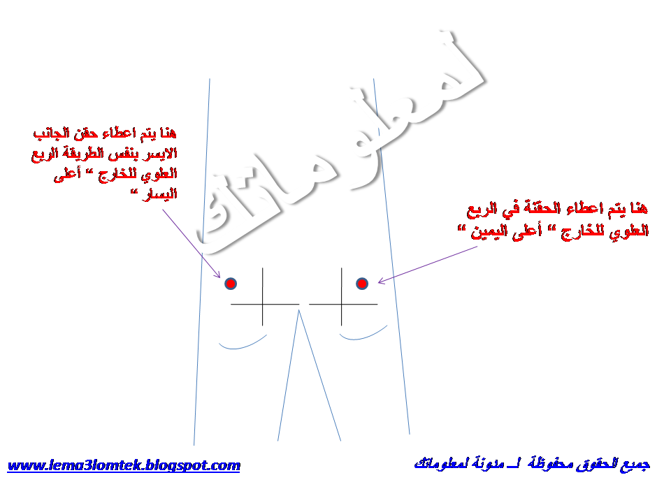 كيف اتعلم اعطاء الحقن