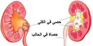 رمل في الرو